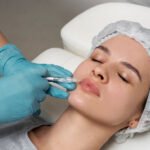How Do Dermal Fillers Work and What Should You Expect?