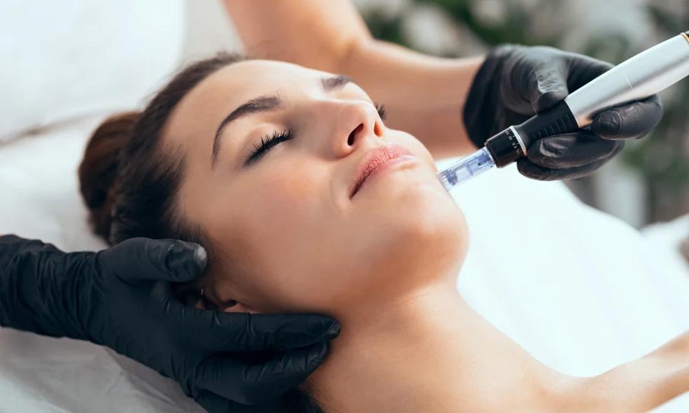 What Is Microneedling Good For? 7 Benefits You Should Know